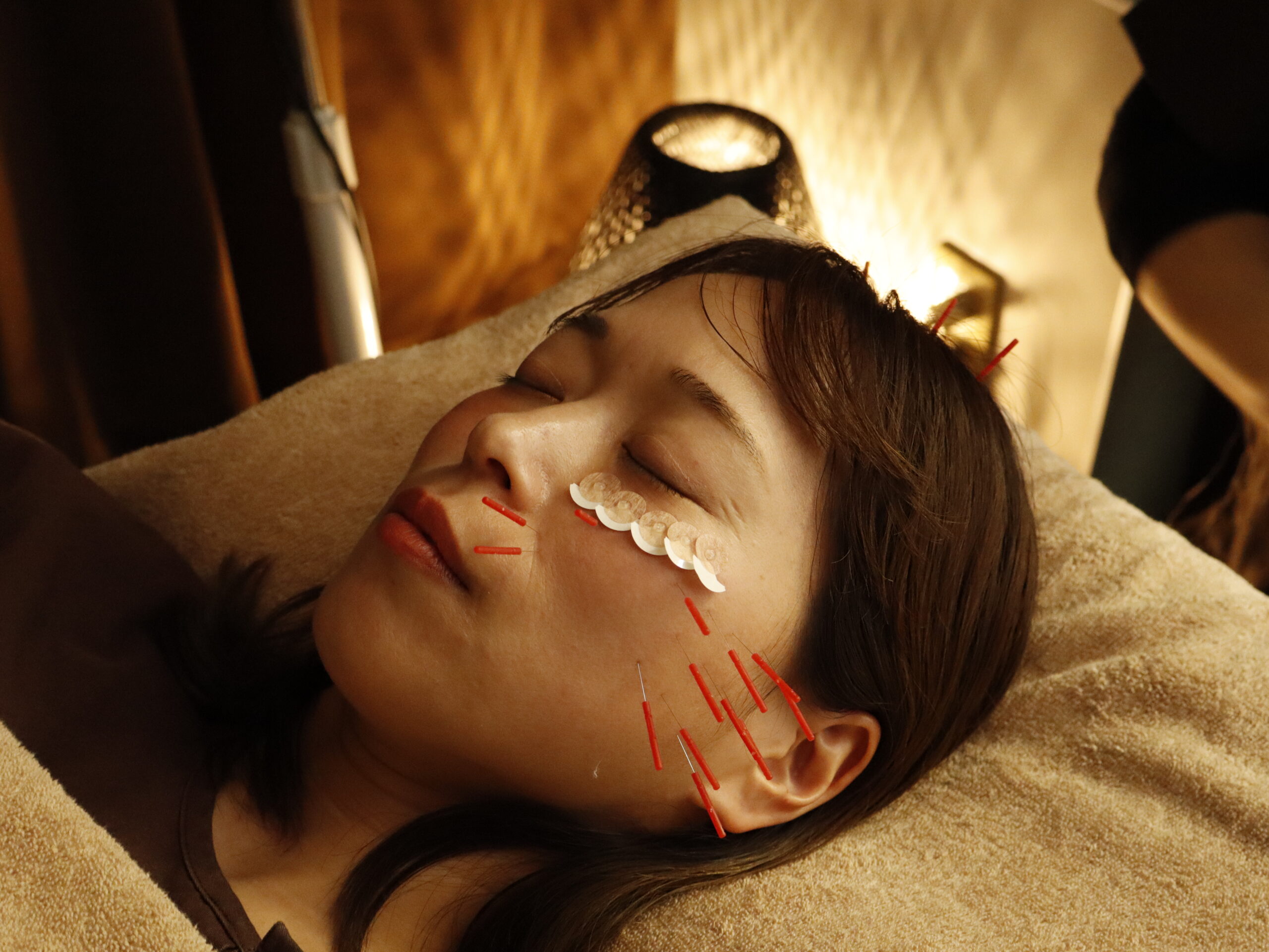 美容鍼のイメージ